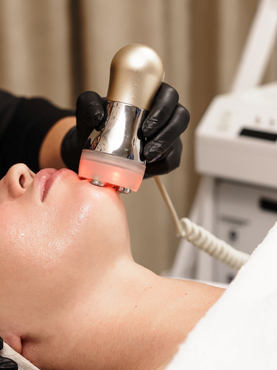 Venus Legacy radiofrequency facial treatment